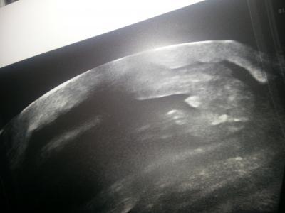 Bild zu geschlecht? - Forum für Dezember - Mamis