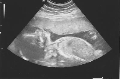 Bild zu Ich hatte heute wieder einen FA-Termin... - Forum für Dezember - Mamis