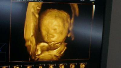 Bild zu FA Termin Zuckertest und 3D Ultraschall - Forum für Dezember - Mamis