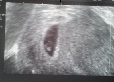 Bild zu Zurück vom Gyn... - Forum für Dezember - Mamis