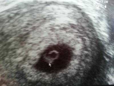 Bild zu Darf ich vorstellen... - Forum für Dezember - Mamis