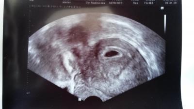 Bild zu tadaaa... - Forum für Dezember - Mamis