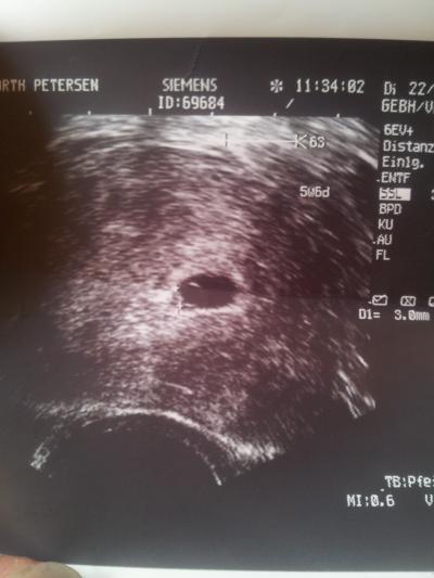 Bild zu so, war beim fa :-) - Forum für Dezember - Mamis