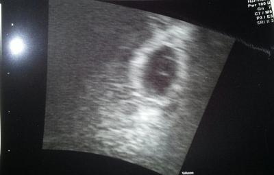 Bild zu FA-Bericht+Bildchen - Forum für Dezember - Mamis