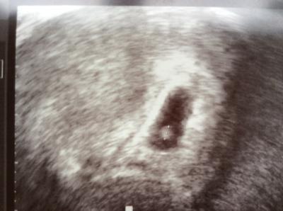 Bild zu Noch ein Herzchen das schlägt - Forum für Dezember - Mamis