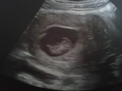 Bild zu Mutterpass und Verwirrung... - Forum für Dezember - Mamis
