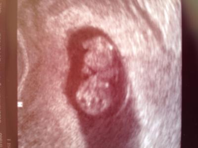 Bild zu Wieder zurück... - Forum für Dezember - Mamis