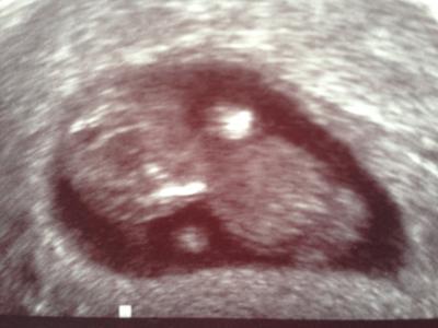 Bild zu Glücklicher Zwischenbericht - Forum für Dezember - Mamis