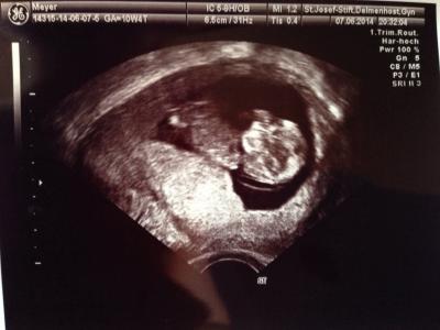 Bild zu US - Forum für Dezember - Mamis