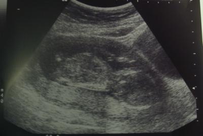 Bild zu Wir waren beim Gyn zur Vorsorge - Forum für Dezember - Mamis