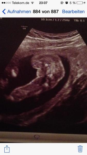 Bild zu Zweites großes Screening plus Outing :-) - Forum für Dezember - Mamis