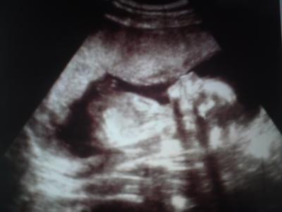 Bild zu Mein Töchterchen- darf ich vorstellen? - Forum für Dezember - Mamis