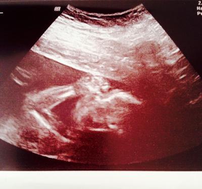 Bild zu Es wird dooooch ein Junge :) - Forum für Dezember - Mamis