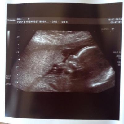 Bild zu Ultraschall und Outing - Forum für Dezember - Mamis