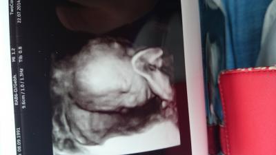 Bild zu zurück vom Organscreening :-D - Forum für Dezember - Mamis
