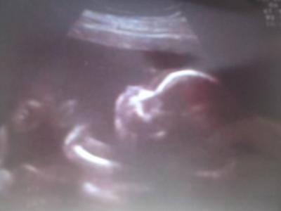 Bild zu Update von uns - Forum für Dezember - Mamis