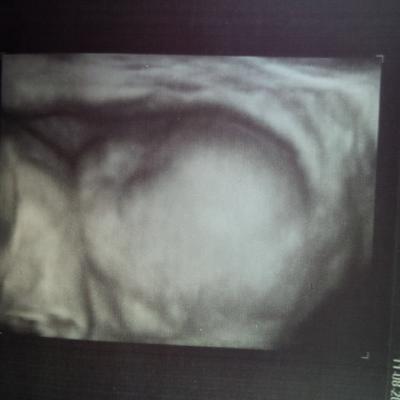 Bild zu VU und Extra-US - Forum für Dezember - Mamis