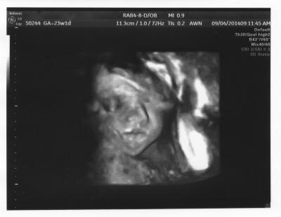Bild zu Meine kleine Motte - Forum für Dezember - Mamis