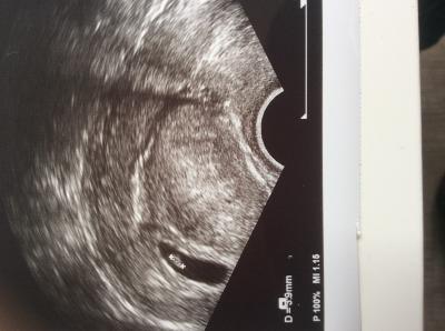 Bild zu Zurück vom FA und überglücklich :-) - Forum für Dezember - Mamis