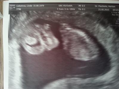Bild zu FA Termin - wieder da! - Forum für Dezember - Mamis