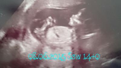 Bild zu Ssw 15 und Fa Termin - Forum für Dezember - Mamis