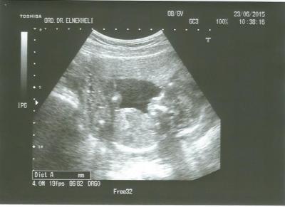 Bild zu Ultraschall - Wir wissen es jetzt! - Forum für Dezember - Mamis