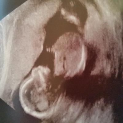 Bild zu Frauenarzt - Forum für Dezember - Mamis