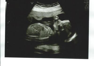 Bild zu Organscreening - Forum für Dezember - Mamis