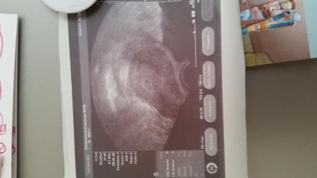 Bild zu US Termin - Forum für Dezember - Mamis