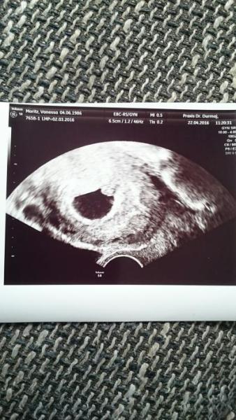 Bild zu Herz blubbert.... - Forum für Dezember - Mamis