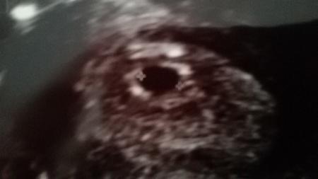 Bild zu auch zurück vom Fa :-/ - Forum für Dezember - Mamis