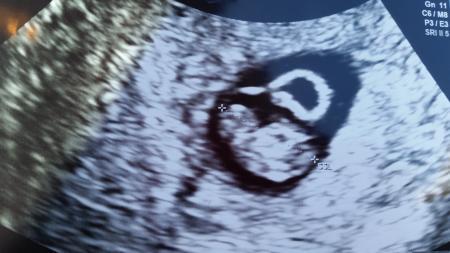 Bild zu War auch beim FA. .. - Forum für Dezember - Mamis