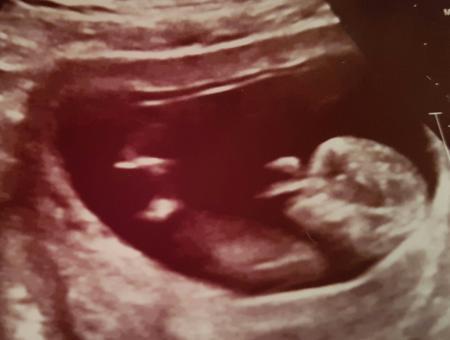 Bild zu Termin heute - Forum für Dezember - Mamis