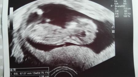 Bild zu NUB, wer kennt sich aus? - Forum für Dezember - Mamis