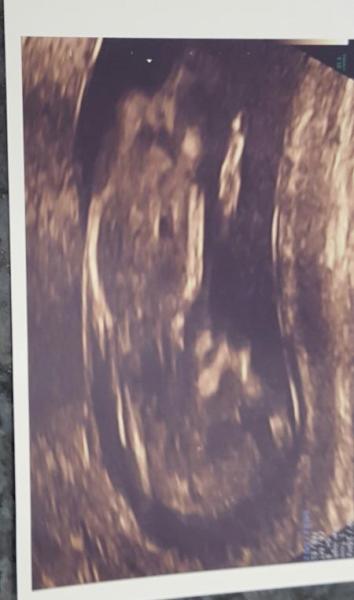 Bild zu Ersttrimesterscreening + Foto - Forum für Dezember - Mamis