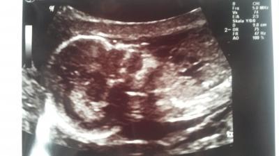 Bild zu Mal wieder Bericht erstatten :) - Forum für Dezember - Mamis