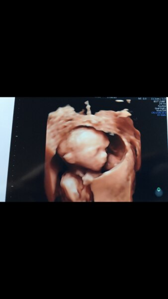 Bild zu Neues Bild vom Krümel - Forum für Dezember - Mamis