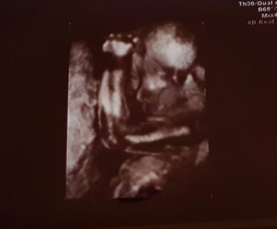 Bild zu Glukosetoleranztest - Forum für Dezember - Mamis