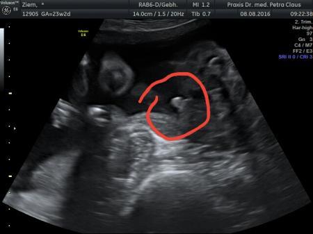 Bild zu Zurück vom FA + eindeutiges Outing! - Forum für Dezember - Mamis