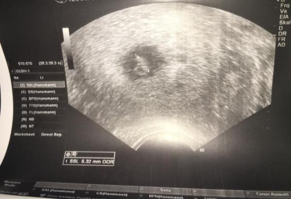 Bild zu Ich reihe mich auch wieder ein.... - Forum für Dezember - Mamis