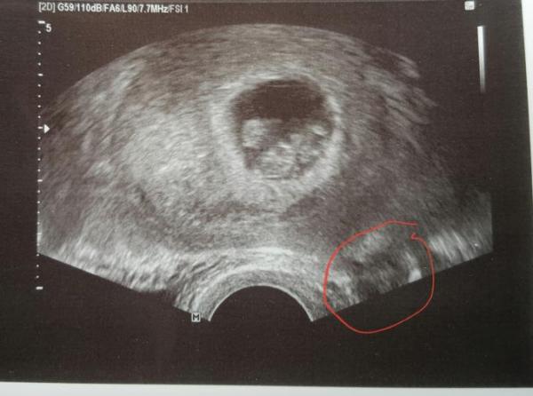 Bild zu Absolute Bettruhe - Forum für Dezember - Mamis