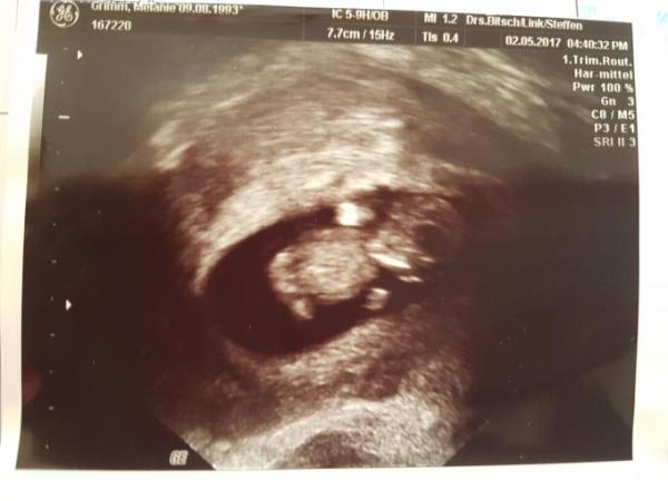 Bild zu Erstes Babyfoto bekommen 😍 - Forum für Dezember - Mamis