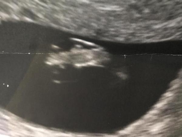Bild zu Zurück vom FA - Forum für Dezember - Mamis