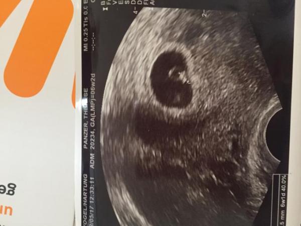 Bild zu 1. FÄ Termin Freude und Angst - Forum für Dezember - Mamis