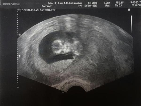 Bild zu Schon große 5,03 cm - Forum für Dezember - Mamis