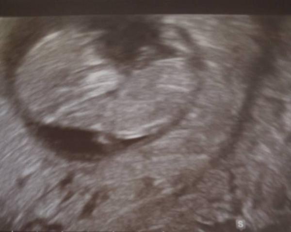 Bild zu Krümel Bild - Forum für Dezember - Mamis