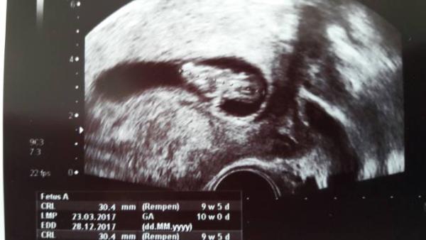 Bild zu Zurück... - Forum für Dezember - Mamis