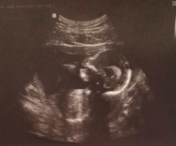 Bild zu Update :) - Forum für Dezember - Mamis