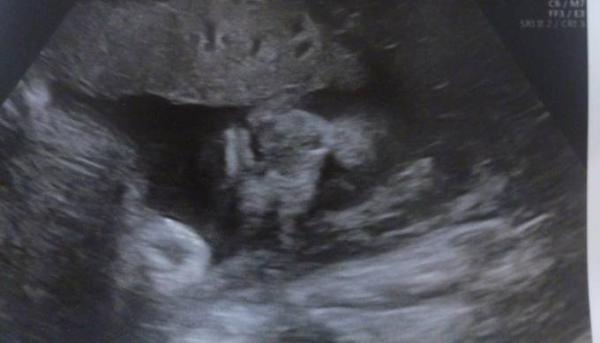 Bild zu 3. Ultraschall mit müder Maus - Forum für Dezember - Mamis