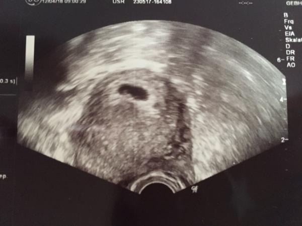 Bild zu Das Herzchen schlägt :) - Forum für Dezember - Mamis